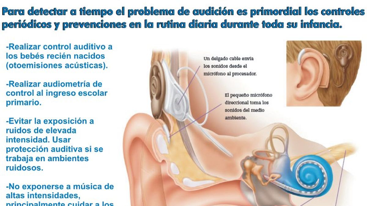 M Todos Para Una Detecci N Temprana De La Sordera Infantil