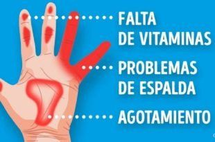 Las y manos pies en espalda hormigueo