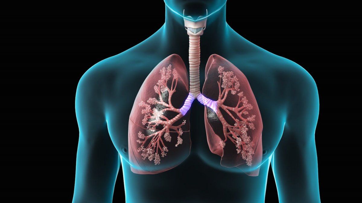 Hipertensión Arterial Pulmonar Una Afección Grave Y Poco Conocida