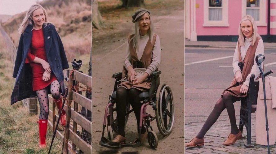 La rara enfermedad que sufre esta estrella de Instagram