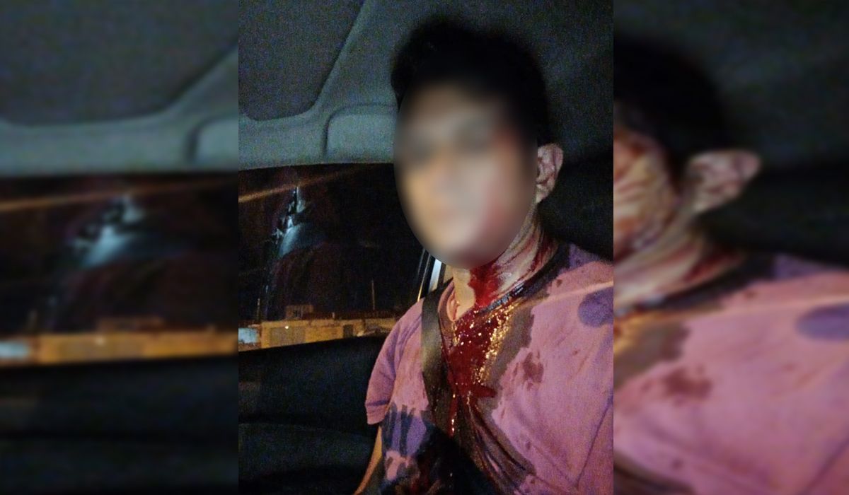 Salvaje agresión a un taxista en Alto Comedero: lo atacaron con un ladrillo