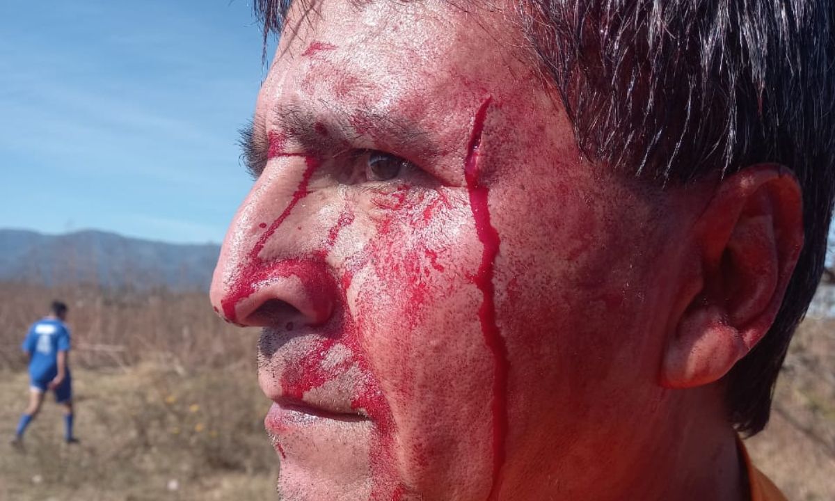 Nuevamente, violencia en Palpalá: agredieron a un árbitro en un torneo barrial