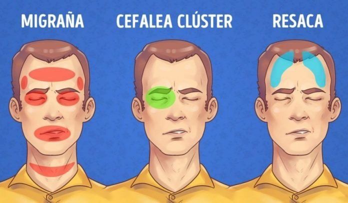 Tipos de dolor de cabeza y cómo puedes aliviarlos