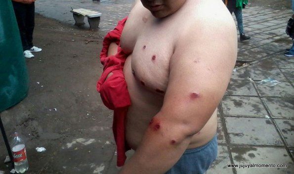 Brutal represión de la Policía a trabajadores de la Intersindical
