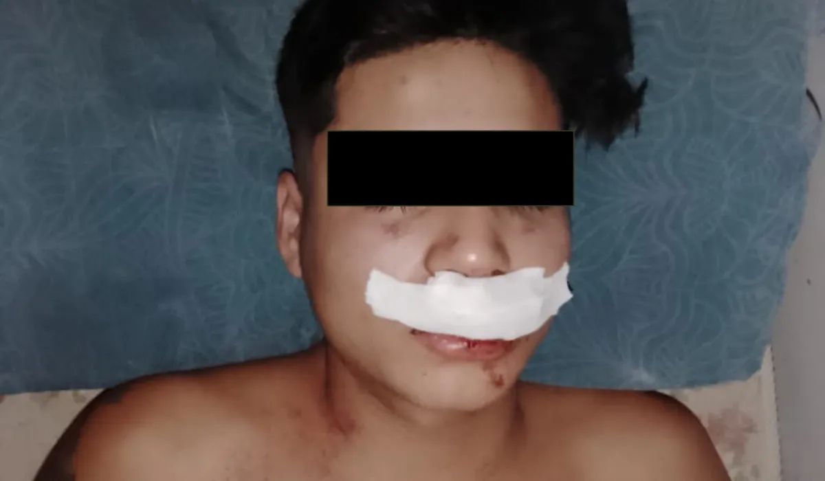 Imagen de uno de los jóvenes agredidos. (Foto de Redes Sociales)