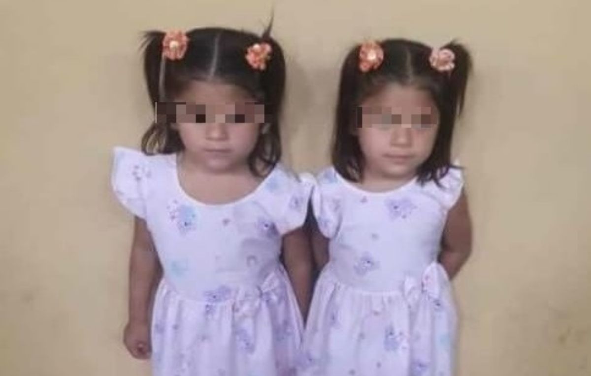 Las gemelas que sufrieron graves quemaduras en Monterrico necesitan ayuda