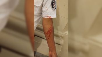 Policía resultó herido tras enfrentar a delincuente en un robo