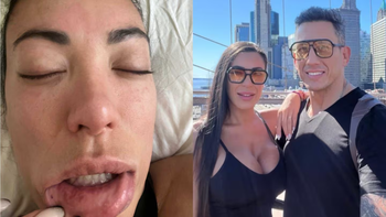 Las impactantes fotos que Pamela Pombo presentó en la causa contra su ex marido