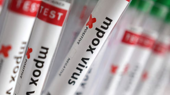 Confirman el primer caso de viruela del mono más agresiva en Argentina