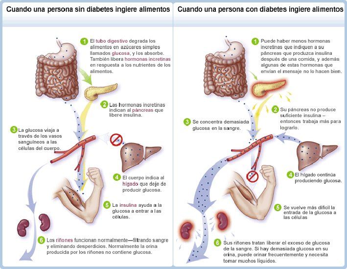 Eliminar diabetes tipo 2