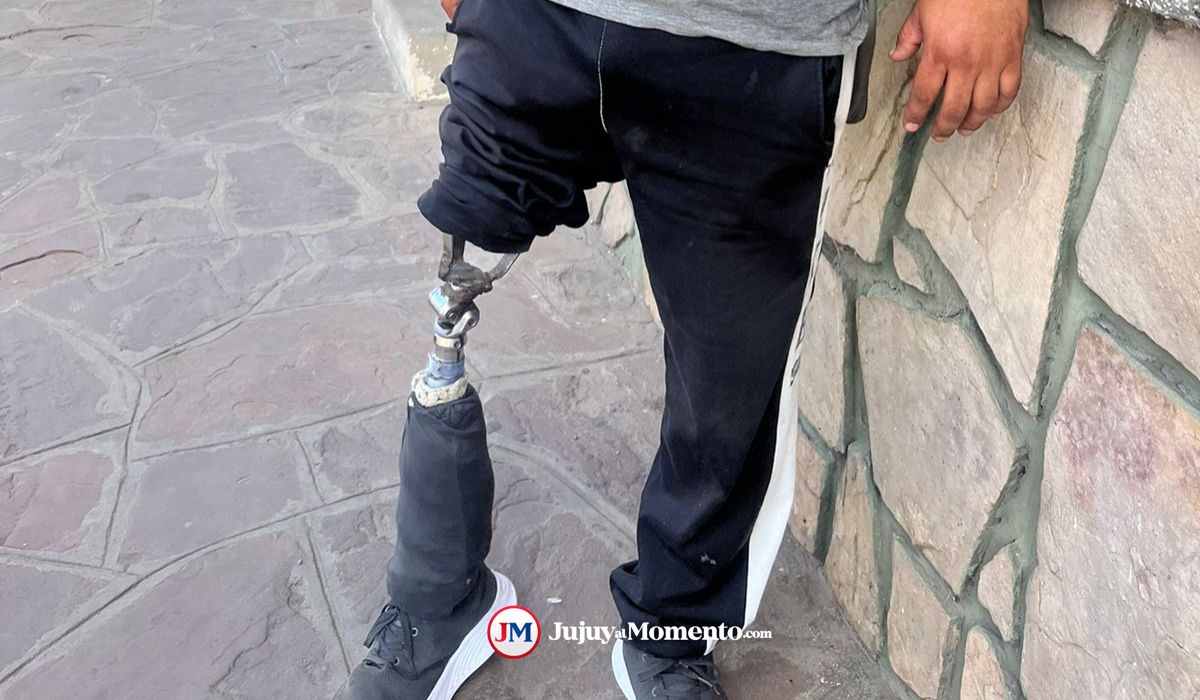 Está sin trabajo y pide ayuda: jujeño necesita reparar su pierna ortopédica