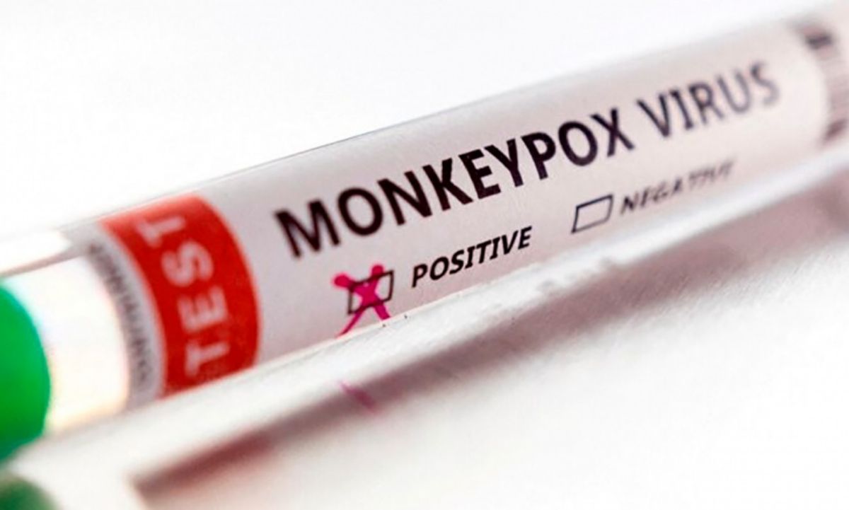 Confirmaron el primer caso de viruela del mono en Mendoza