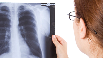 Tuberculosis en Jujuy: medidas de prevención y protocolo de actuación