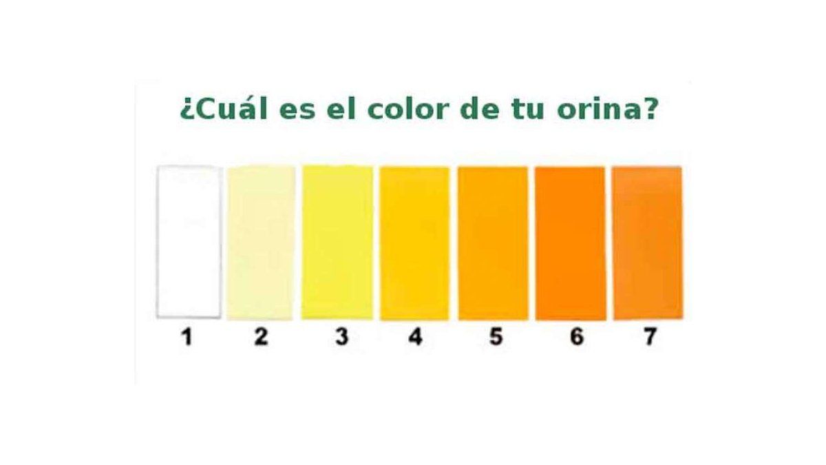 Qué nos dice el color de la orina sobre nuestra salud Qué nos dice el color de la orina sobre nuestra salud