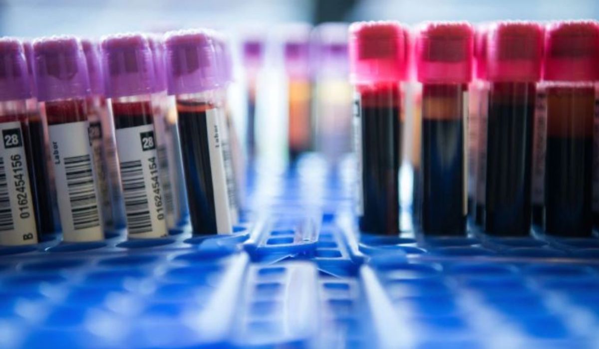 Solo con una gota de sangre: un prometedor test permite la detección temprana de 50 tipos de cáncer